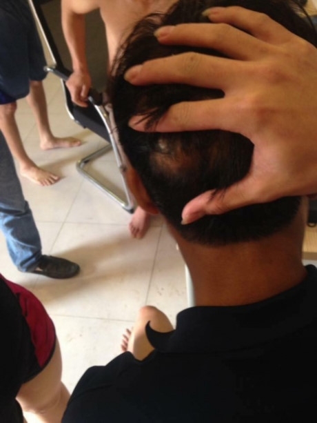 6 nguoi bi thuong khi choi trong cong vien nuoc tai ha long