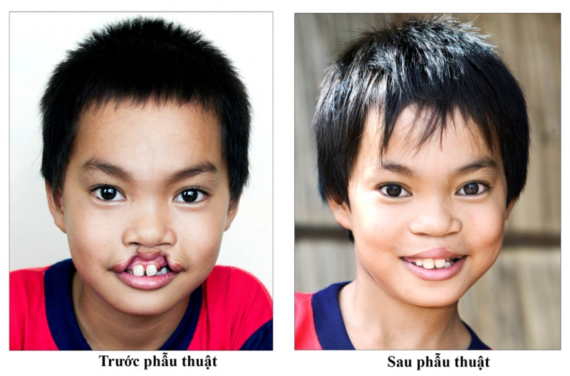 233 trieu dau gia chiec vespa primavera duoc ho tro cho tre em ho ham ech